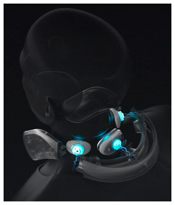 xiaomi_neck_Mas_G2_03