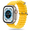 TechProtect_IconBand_Watch_Yellow_01